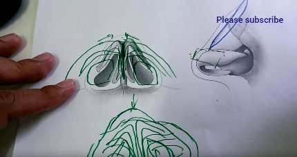 cara operasi plastik hidung