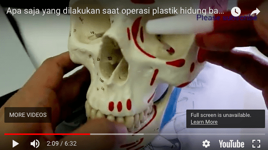 Apakah hidung yang lebar bisa dibuat lebih ramping?